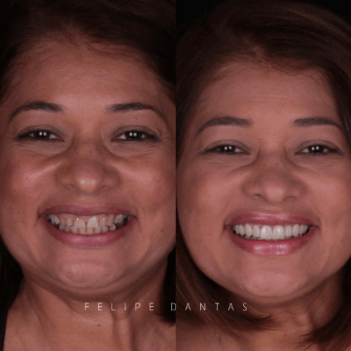 Dr.Felipe Dantas 6