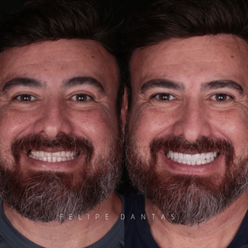 Dr.Felipe dantas 3