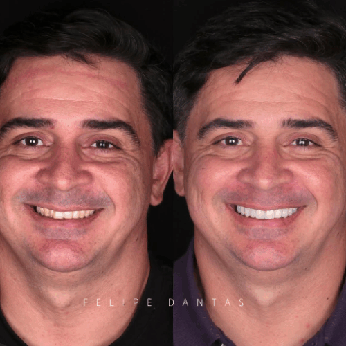 Dr.felipe Dantas 4